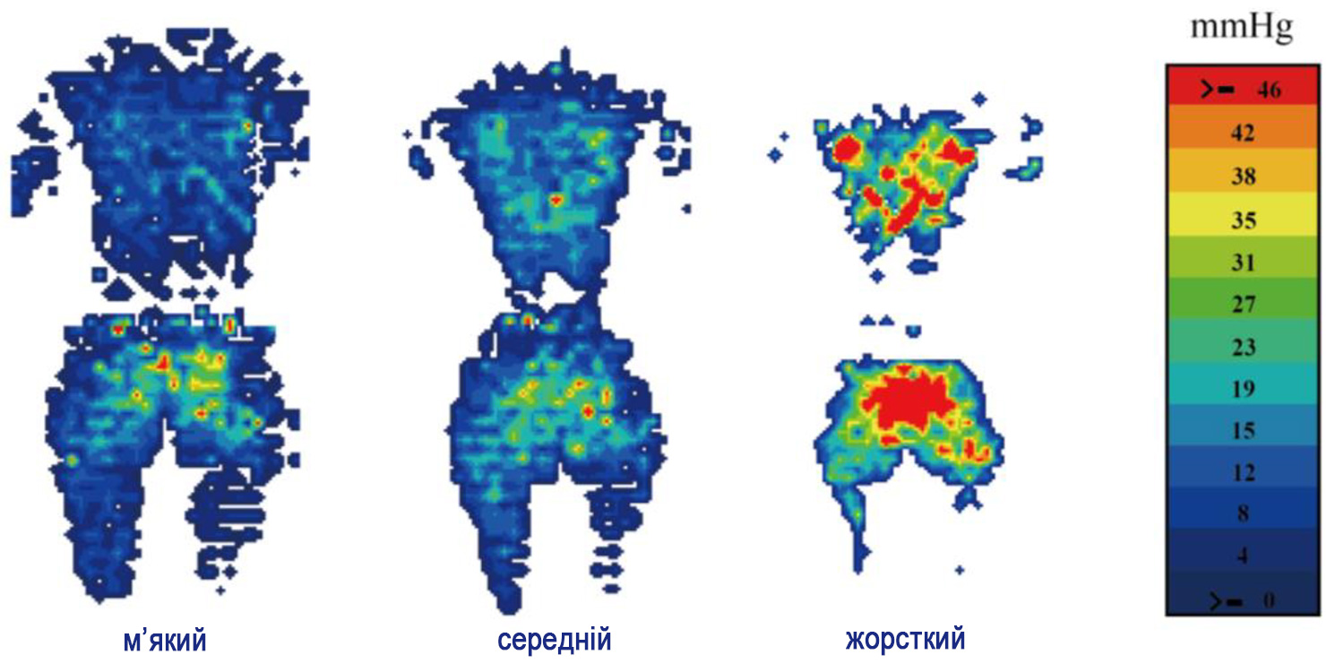 Инфографика, сравнивающая давление на тело на жестком и мягком матрасе